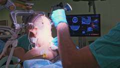 операція мозку